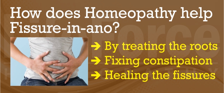 Best Homeopathy Treatment for Fissure in Ano